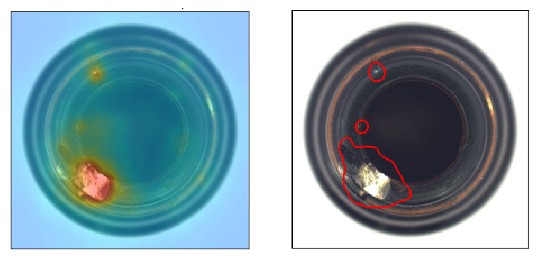 anomaly_detection_01