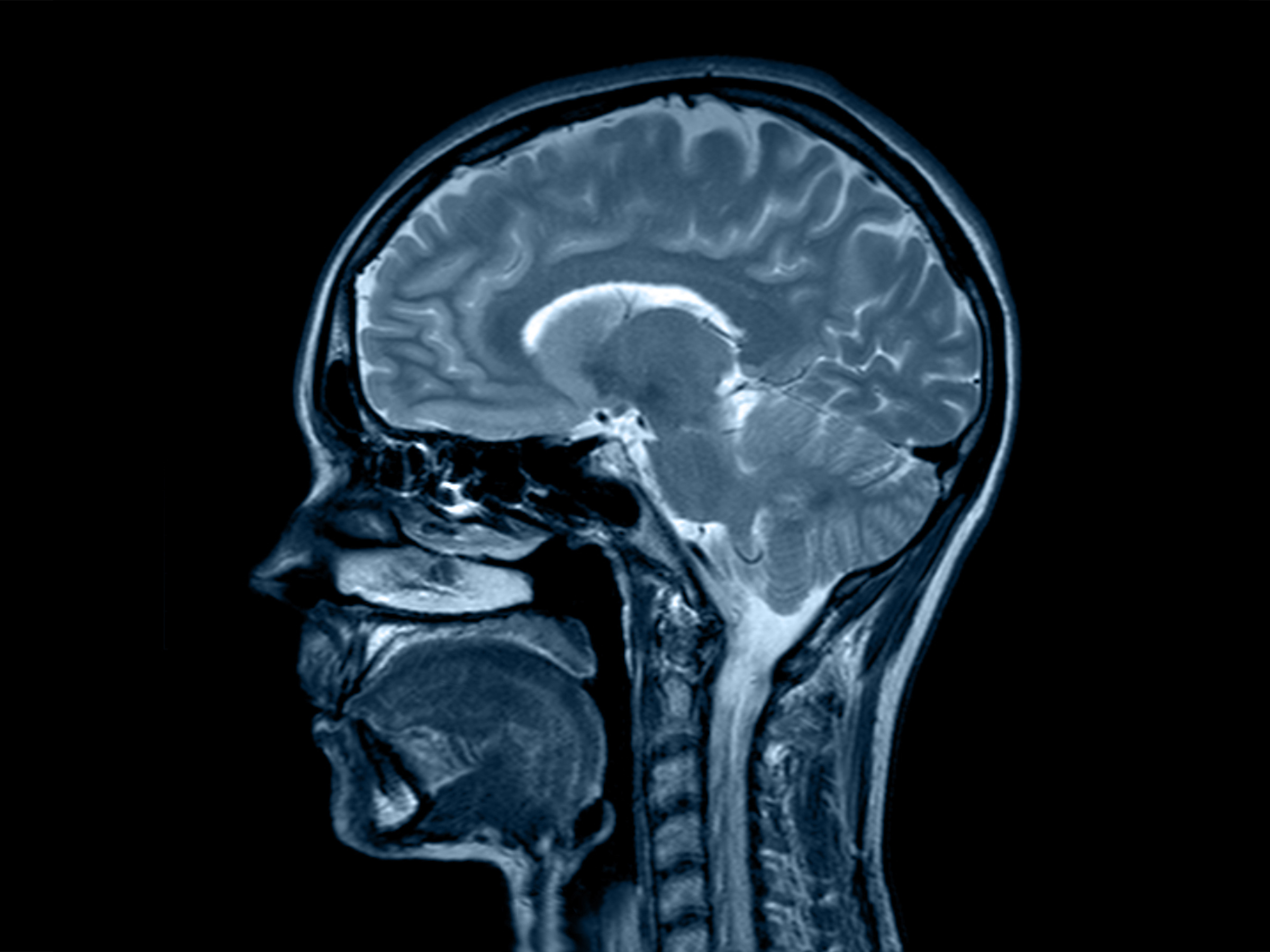brain x-ray ct head vertebrae spine cord incision