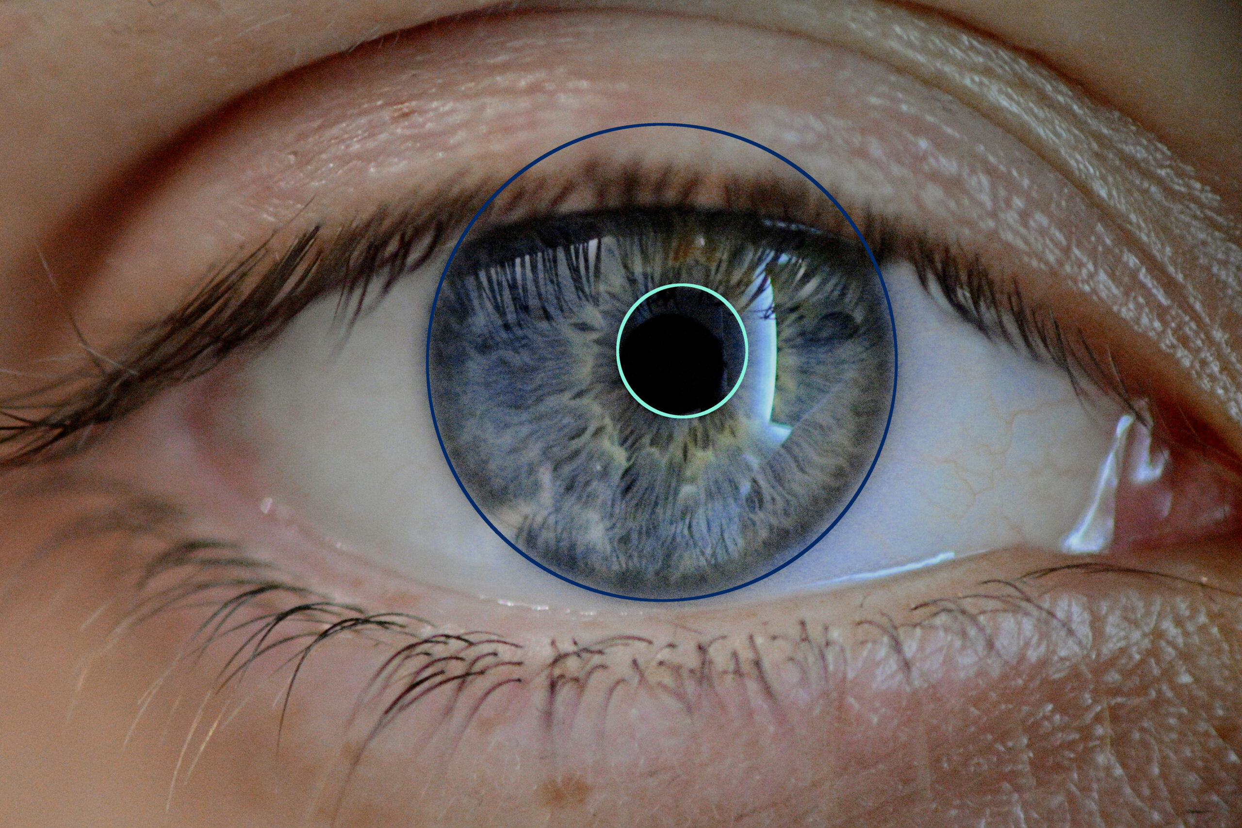 ComputerVision VEO AUTOMATION